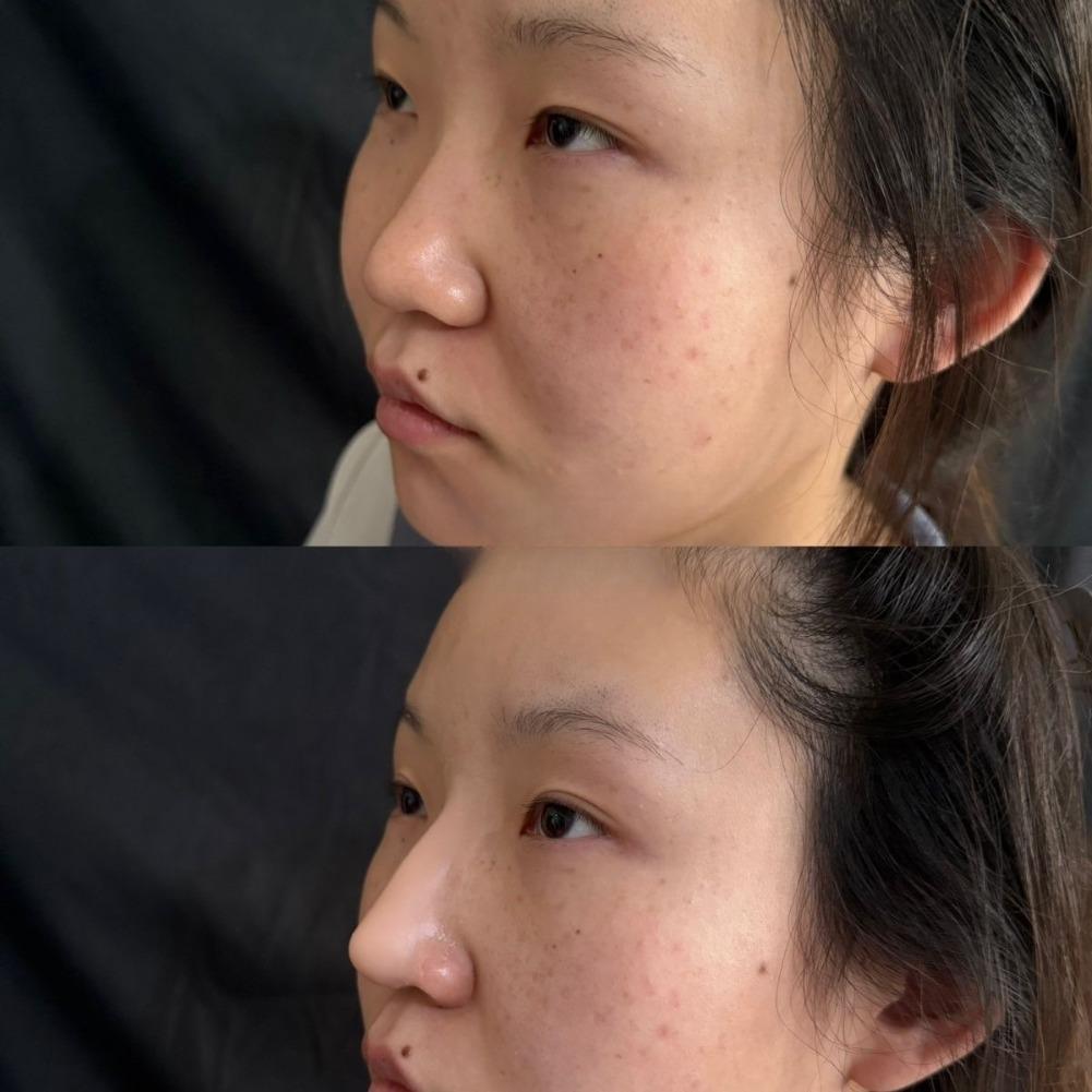  Silicone Fake Nose Kit Soft  - J Beauty Makeup recension och pris